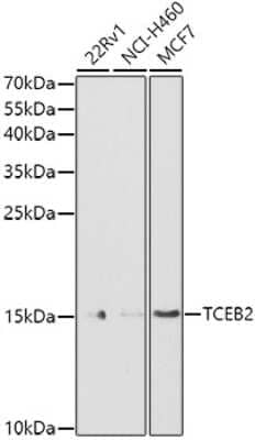 Western Blot: TCEB2 Antibody [NBP2-94034] - Western blot analysis of extracts of various cell lines, using TCEB2 antibody (NBP2-94034) at 1:1000 dilution. Secondary antibody: HRP Goat Anti-Rabbit IgG (H+L) at 1:10000 dilution. Lysates/proteins: 25ug per lane. Blocking buffer: 3% nonfat dry milk in TBST. Detection: ECL Basic Kit. Exposure time: 90s.